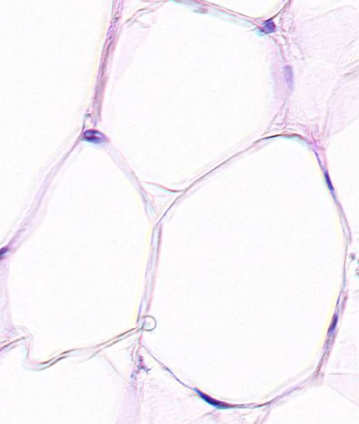 Featured image for “Chapter 3 – Connective Tissues”