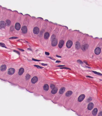 Featured image for “Chapter 2 – Epithelial Tissue”