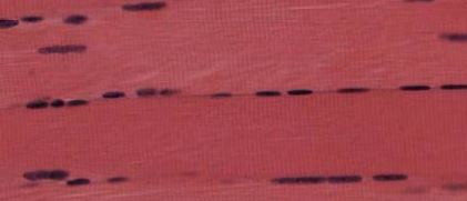 Featured image for “Chapter 4 – Muscle Tissues”