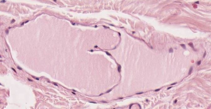 Featured image for “Chapter 9 – Cardiovascular System”