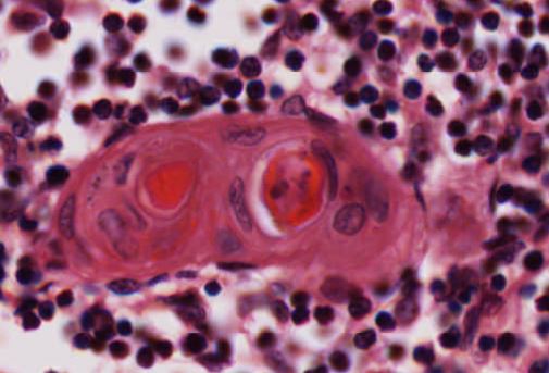 Featured image for “Chapter 10 – Immune System”