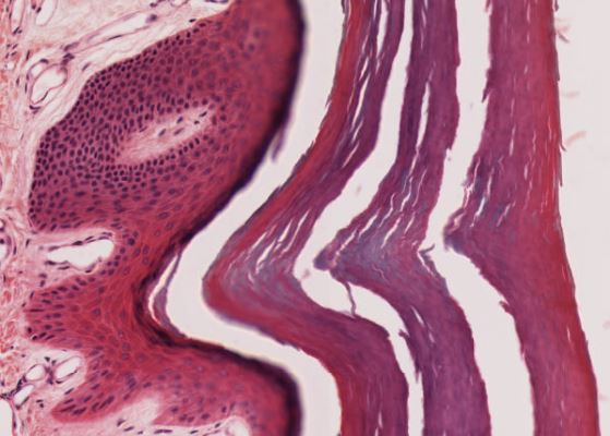 Featured image for “Chapter 6 – Integumentary System”