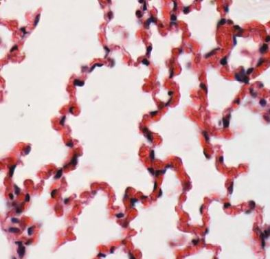 Featured image for “Chapter 11 – Respiratory System”