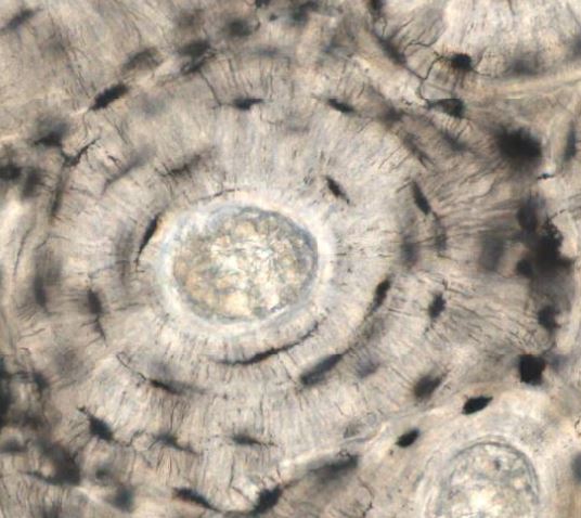 Featured image for “Chapter 7 – Skeletal and Articular Systems”