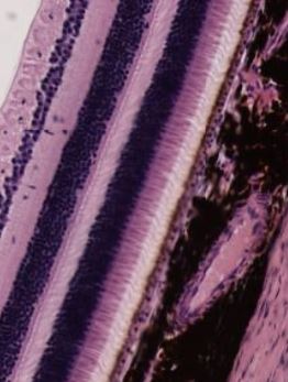 Featured image for “Chapter 16 – Special Senses”