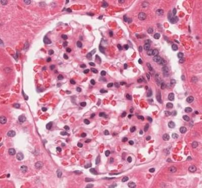 Featured image for “Chapter 13 – Urinary System”