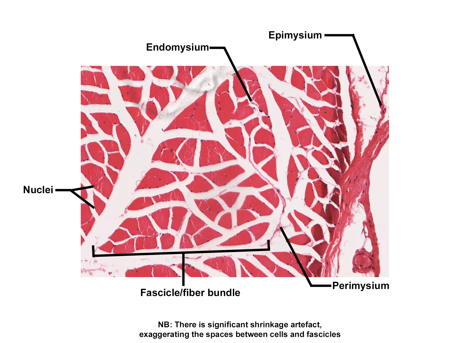 Histological cross-section of skeletal muscle stained with H&E. The image shows multiple fascicles composed of skeletal muscle fibers. Each fiber is surrounded by endomysium, while fascicles are enclosed by perimysium. The entire muscle is covered by epimysium. Multiple nuclei are visible at the periphery of muscle fibers. Note: shrinkage artifact exaggerates spaces between fibers and fascicles. The image illustrates the connective tissue layers and organization of skeletal muscle.