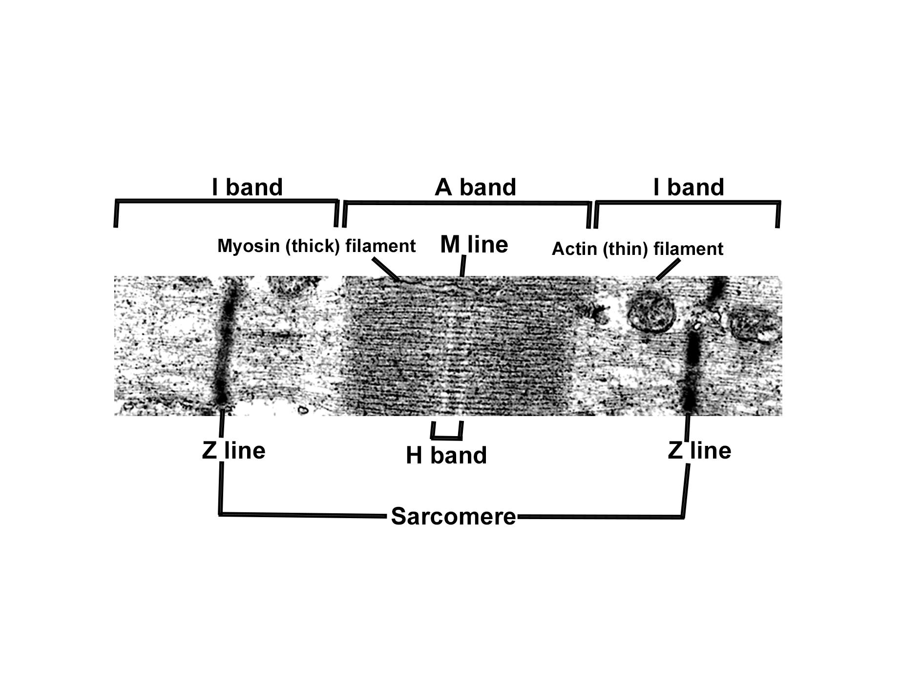 Electron micrograph of a sarcomere showing its structural components. The sarcomere is classified as existing between two Z lines. Each Z line bisects an I band on either side. There is an A band in the center of the sarcomere. The A band contains thick myosin filaments, and is darker (more electron dense), while thin actin filaments anchor to the Z line and extend towards the M line. The H band is located in the middle of the A band, and represents the region of thick filaments that do not overlap with the thin filaments. The M line runs through its center and represents the anchoring point for the thick filaments. The image illustrates the arrangement of myofilaments and the repeating unit of striated muscle.