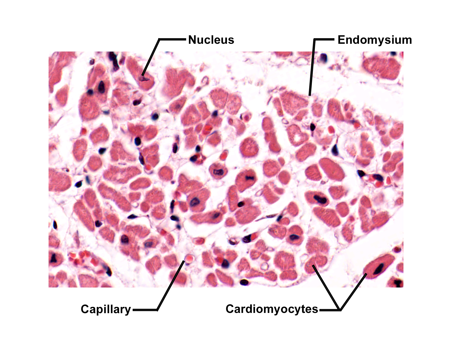 Histological cross-section of cardiac muscle stained with H&E. The image shows numerous acidophilic (pink), rounded cardiomyocytes cut transversely, many having a centrally located nucleus. Capillaries are interspersed between the muscle fibers, and the endomysium, a delicate connective tissue, surrounds individual cells. The image illustrates the structural organization of cardiac muscle tissue, including its vascular supply and connective tissue framework.