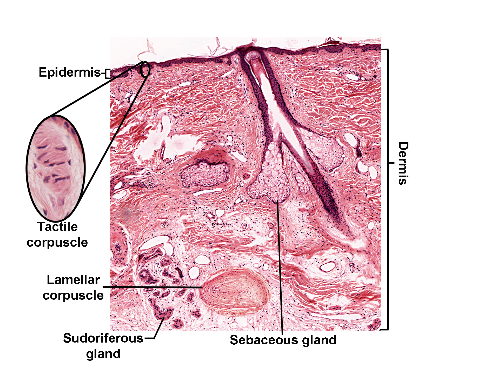 Histological section of skin stained with H&E, showing the epidermis and dermis with associated structures. The epidermis forms the outer layer of stratified squamous keratinized epithelium, while the dermis contains loose (papillary dermis) and dense irregular (reticular dermis) connective tissues. Within the dermis, a hair follicle extends downward, accompanied by a sebaceous gland. A sudoriferous (sweat) gland is present deeper in the dermis. Sensory structures include a tactile corpuscle located near the epidermis, shown in a magnified inset, and a lamellar corpuscle situated in the deeper dermis. The image illustrates the organization of skin layers and associated glands and sensory receptors.