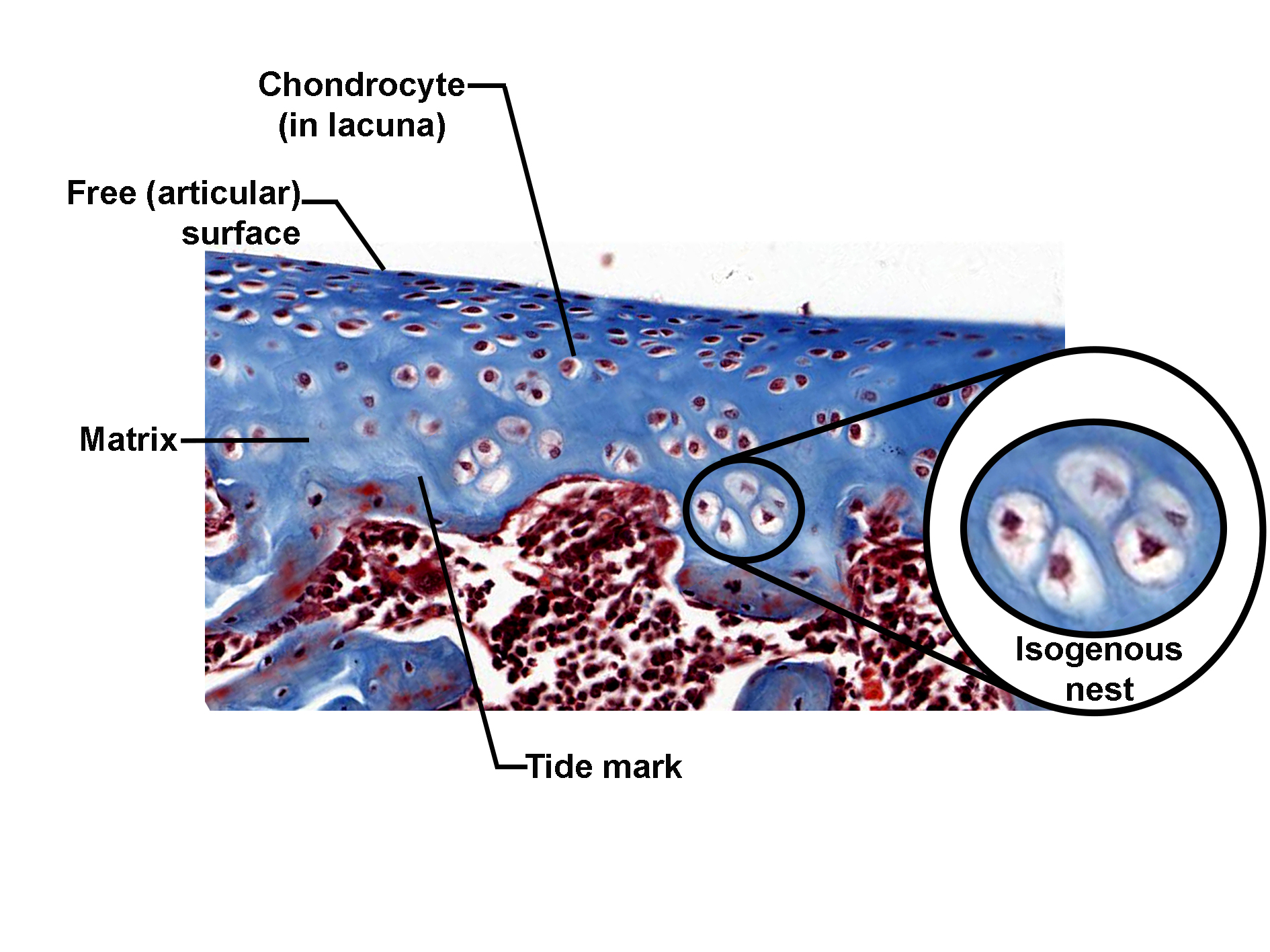 Histological section of hyaline cartilage stained with a connective tissue stain, showing the free articular surface and underlying matrix. Chondrocytes are located within lacunae and arranged in clusters called isogenous nests, highlighted in an inset. The cartilage matrix appears smooth and homogeneous, and a distinct tide mark separates the non-calcified cartilage from the underlying calcified zone. The image illustrates the structural organization of hyaline cartilage and its cellular arrangement.