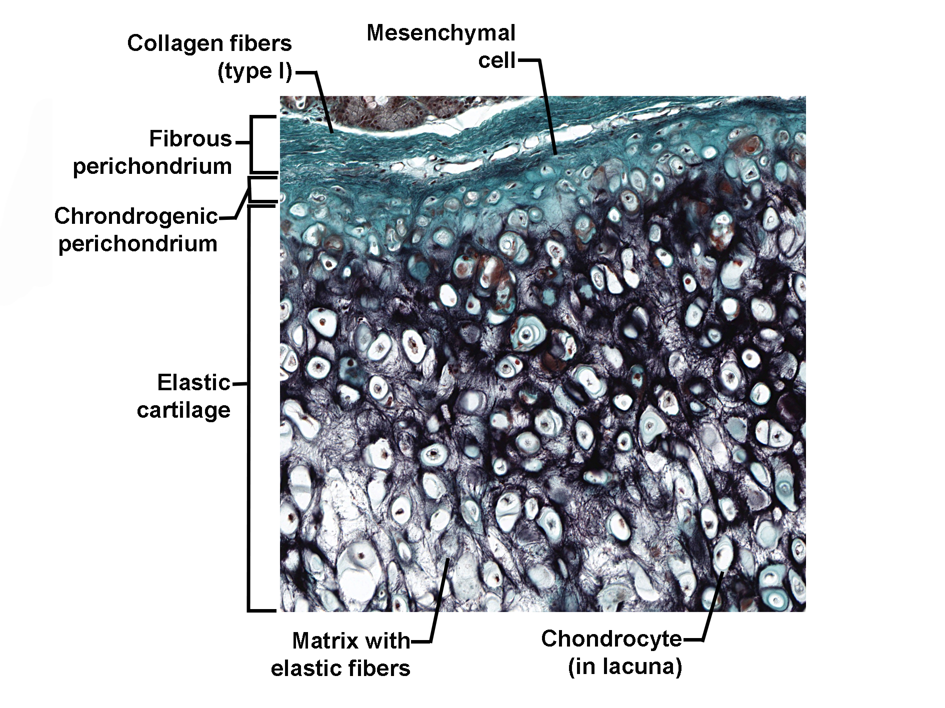 Histological section of elastic cartilage stained with a special connective tissue stain, showing chondrocytes within lacunae embedded in a matrix rich in elastic fibers. The cartilage is surrounded by a perichondrium with two layers: an outer fibrous layer containing type I collagen fibers and mesenchymal cells, and an inner chondrogenic layer adjacent to the cartilage. The elastic cartilage matrix appears dark due to elastic fibers, and chondrocytes are distributed throughout. The image illustrates the structural organization of elastic cartilage and its perichondrium.