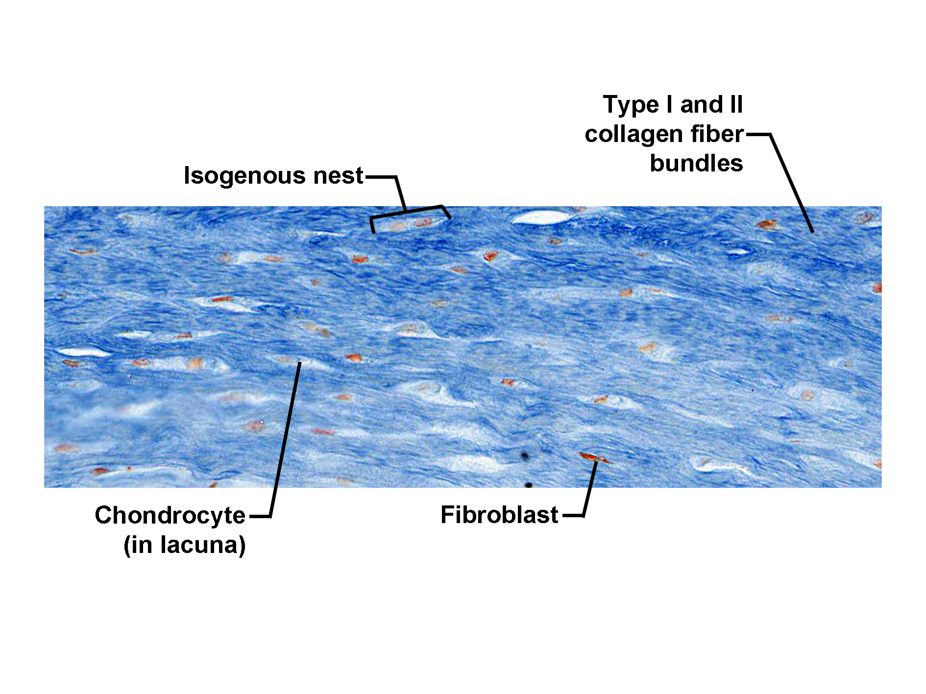 Histological section of fibrocartilage stained with a connective tissue stain, showing dense bundles of type I and type II collagen fibers arranged in parallel. Scattered chondrocytes are located within lacunae, often forming small isogenous nests. Fibroblasts are interspersed among the collagen fibers, contributing to matrix production. The image illustrates the structural organization of fibrocartilage, combining features of dense connective tissue and cartilage for tensile strength and resilience.
