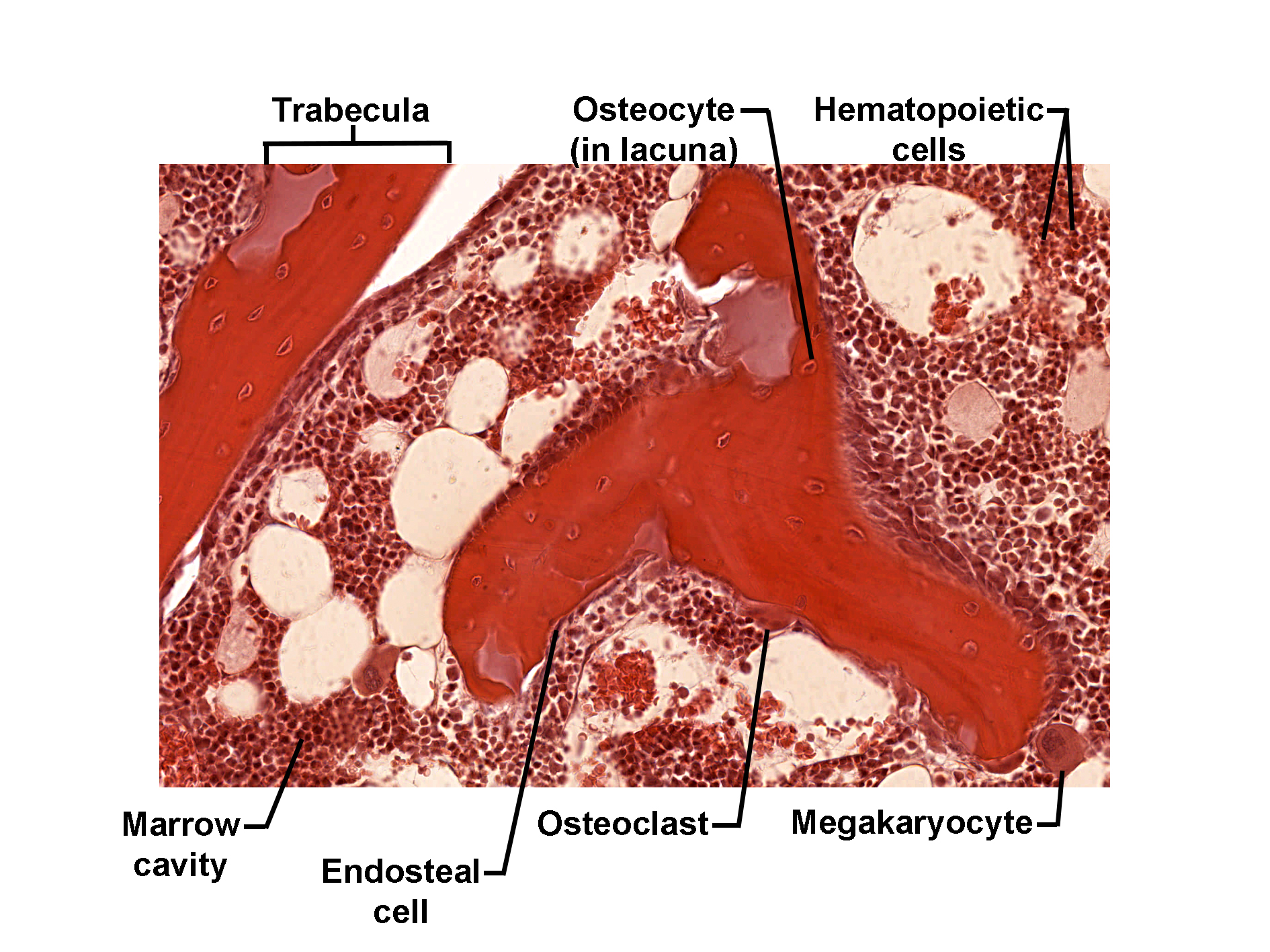 Histological section of spongy bone stained with H&E, showing trabeculae of bone surrounded by marrow cavities. Osteocytes are visible within lacunae inside the trabeculae, while osteoclasts are located along the bone surface for resorption. Endosteal cells line the marrow cavity. The marrow contains hematopoietic cells and large megakaryocytes involved in platelet formation. The image illustrates the structural relationship between trabecular bone and bone marrow components.