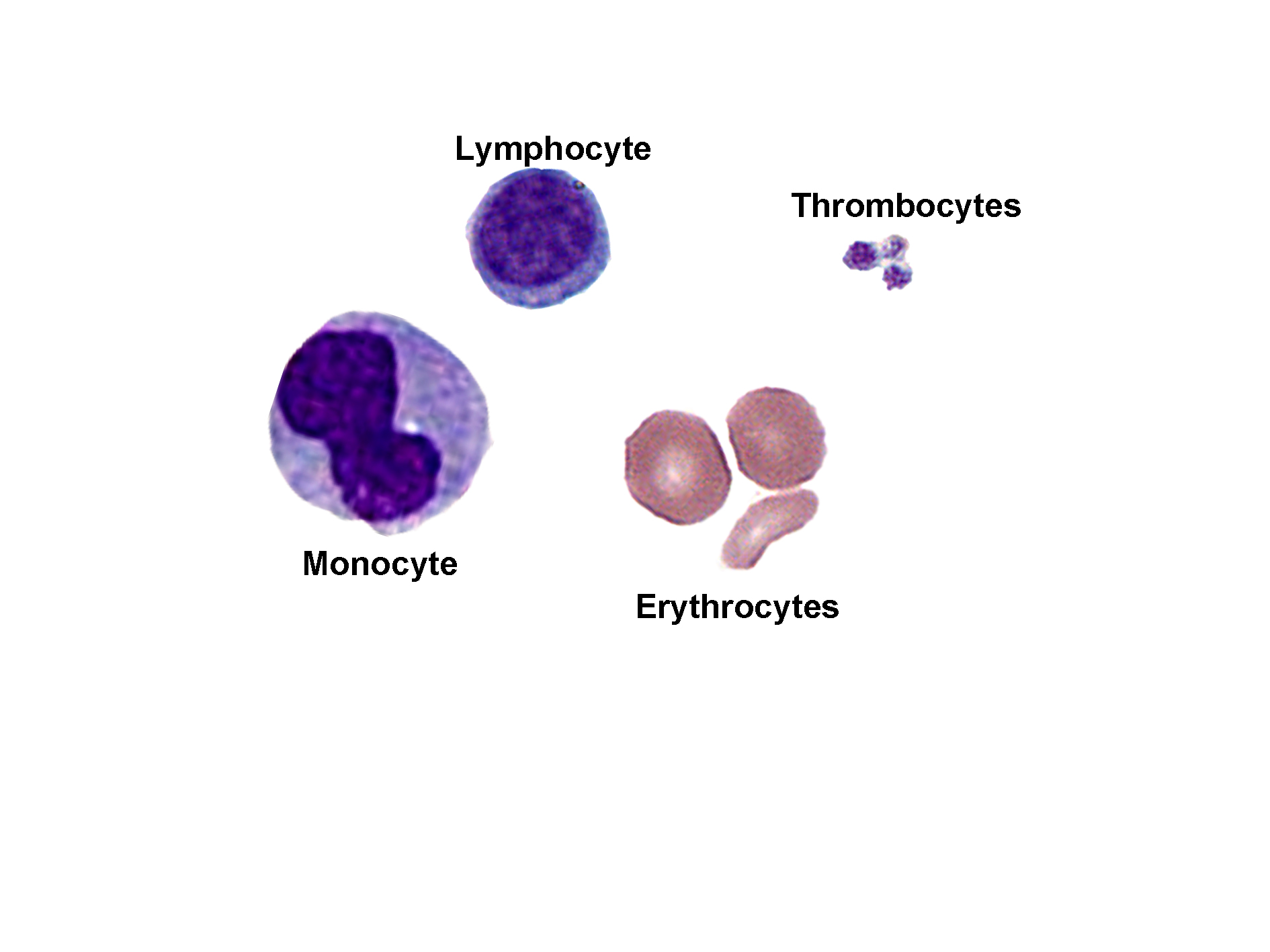 An image showing examples of agranulocytes and other blood elements. A large monocyte with an indented nucleus and abundant cytoplasm is visible on the left. A lymphocyte with a round nucleus and thin rim of cytoplasm is shown above center. Two erythrocytes (red blood cells) appear as biconcave discs in pink, and several small thrombocytes (platelets) are clustered near the top right. The image illustrates the morphological differences between monocytes, lymphocytes, erythrocytes, and thrombocytes.