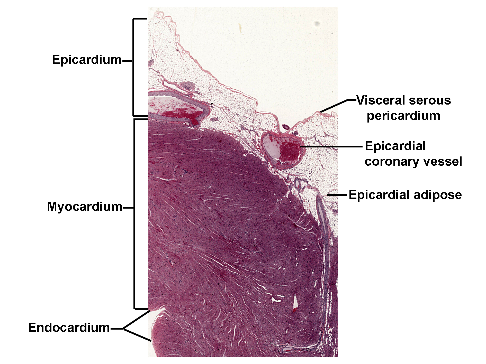 Histological section of the heart wall stained with H&E, showing its three main layers. The innermost layer is the endocardium, lining the cardiac chambers. The thick middle layer is the myocardium, composed of cardiac muscle fibers arranged in bundles. The outer layer is the epicardium, which includes the visceral serous pericardium, epicardial adipose tissue, and an epicardial coronary vessel embedded within the fat. The image illustrates the layered structure of the heart wall and its association with connective tissue and vasculature.