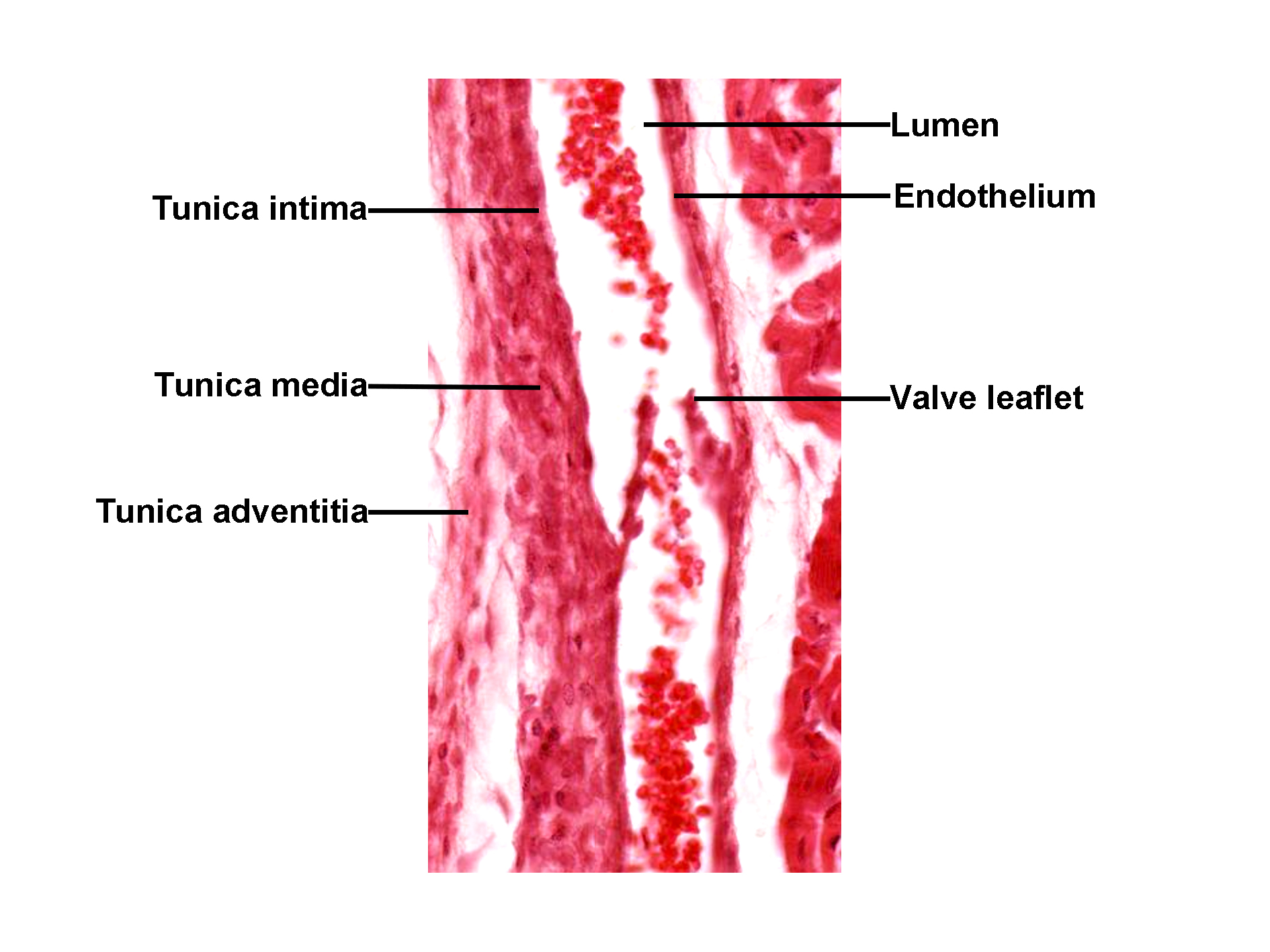 Histological section of a vein stained with H&E, showing the lumen lined by endothelium. The tunica intima forms the innermost layer, followed by the tunica media composed of smooth muscle, and the outer tunica adventitia of connective tissue. A valve leaflet projects into the lumen, covered by endothelium. The image illustrates the layered structure of the vein wall and the presence of venous valves.