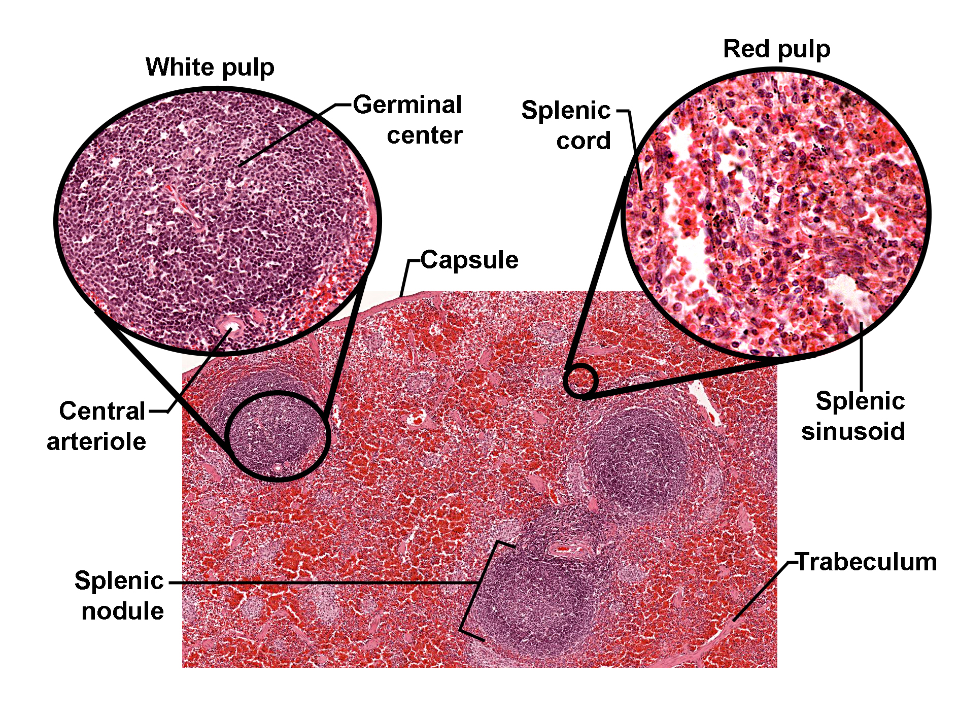Histological section of the spleen stained with H&E, showing the capsule and underlying splenic tissue. The image highlights two main regions: white pulp and red pulp. White pulp appears as lymphoid nodules surrounding a central arteriole, with a germinal center visible in an inset. Red pulp occupies the majority of the section and consists of splenic cords and sinusoids, shown in a magnified inset with numerous erythrocytes. A trabeculum extends inward from the capsule. The image illustrates the spleen’s dual role in immune function and blood filtration through its distinct white and red pulp architecture.
