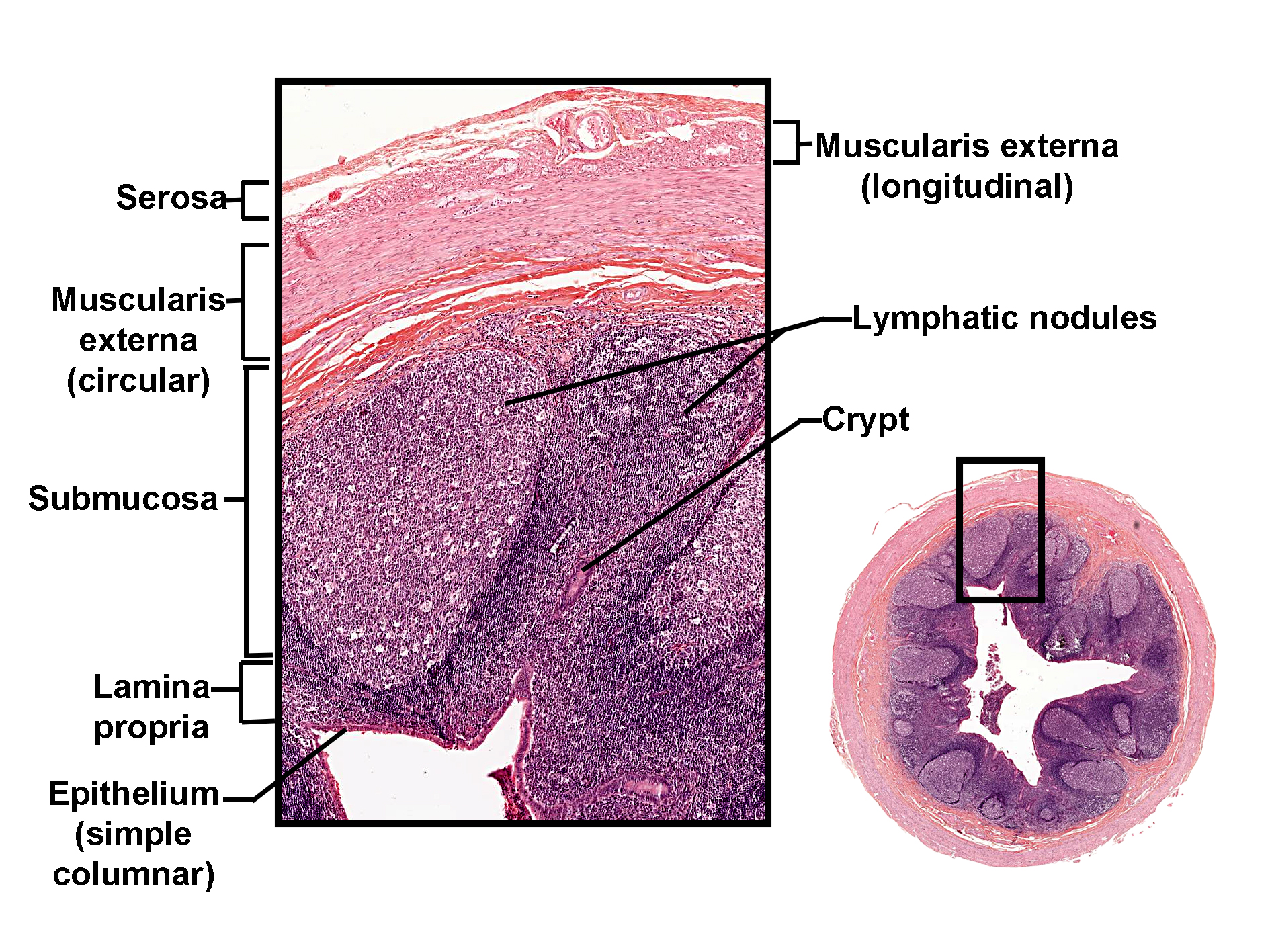 Histological section of the appendix stained with H&E, showing the layered structure of the wall. The innermost layer is the mucosa, lined by simple columnar epithelium with goblet cells and supported by lamina propria. Numerous lymphatic nodules occupy the mucosa and submucosa, surrounding the intestinal crypts. The muscularis externa consists of an inner circular layer and an outer longitudinal layer of smooth muscle. The outermost serosa is visible, lined by mesothelium. A magnified inset highlights the mucosa, submucosa with lymphoid tissue, and muscular layers. The overall image illustrates the appendix’s prominent lymphoid tissue and its tubular organization.