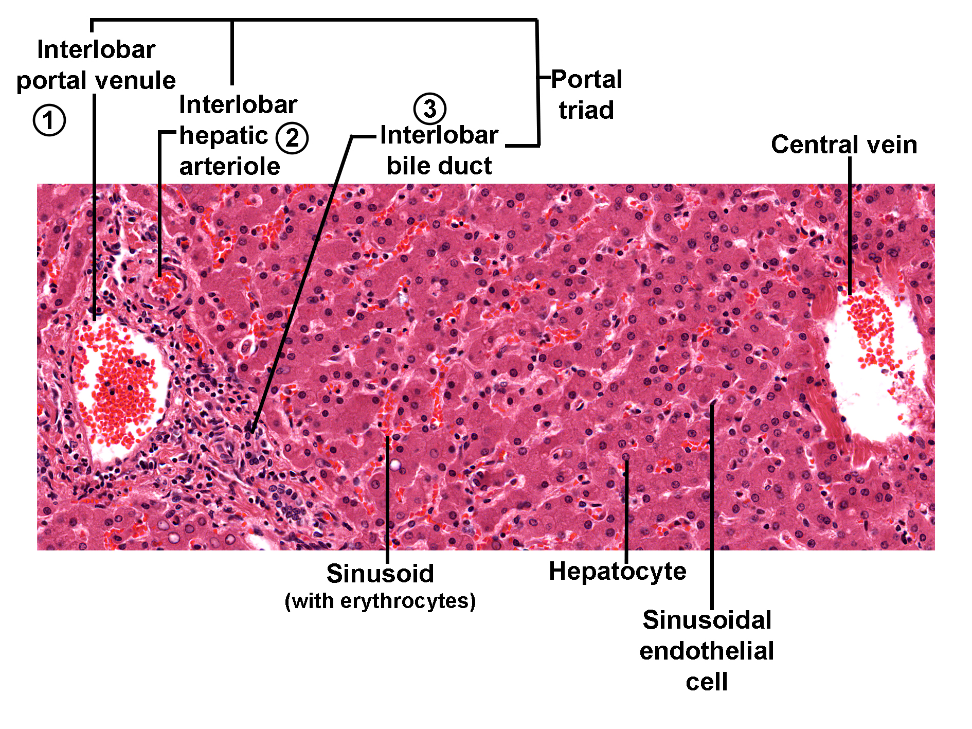 Histological section of the liver stained with H&E, showing a classic hepatic lobule. At the periphery, a portal triad is visible, consisting of an interlobar portal venule, interlobar hepatic arteriole, and interlobar bile duct. Sinusoids containing erythrocytes radiate toward the central vein, lined by sinusoidal endothelial cells. Hepatocytes form plates between sinusoids. The image illustrates the structural organization of the liver lobule and the relationship between portal triads, sinusoids, and central vein.