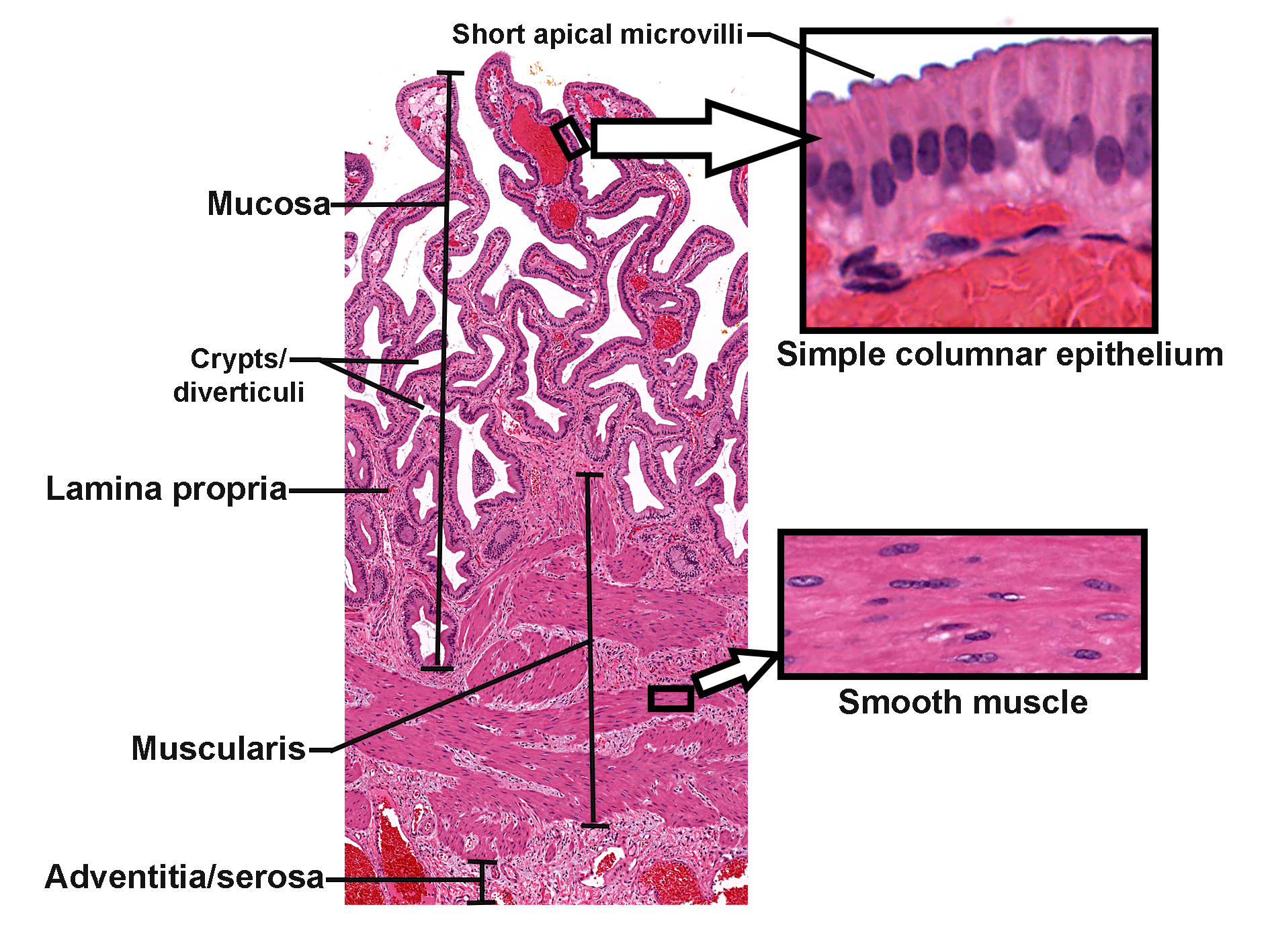 Histological section of the gallbladder stained with H&E, showing the mucosa with tall folds lined by simple columnar epithelium bearing short apical microvilli. Beneath the epithelium lies the lamina propria, followed by the muscularis composed of smooth muscle fibers arranged irregularly. The outermost layer is adventitia or serosa depending on location. Insets highlight the epithelial lining with microvilli and the smooth muscle fibers. The image illustrates the layered structure of the gallbladder wall and its absorptive epithelium.