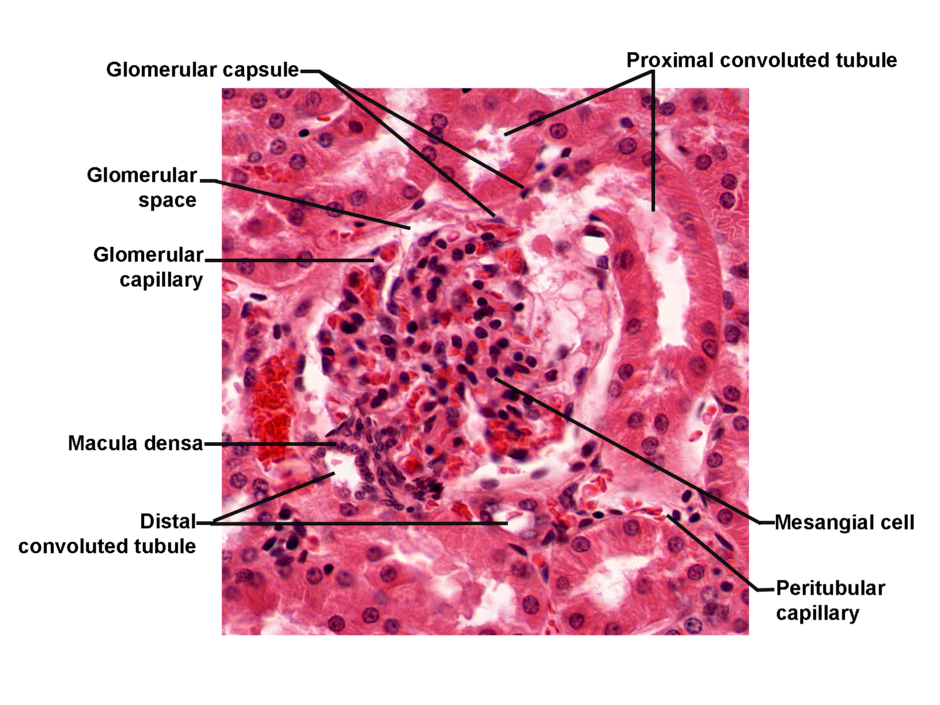 Histological section of the kidney stained with H&E, showing a renal corpuscle and surrounding tubules. The glomerulus is visible within the glomerular capsule, with glomerular capillaries and intervening mesangial cells. The glomerular space surrounds the capillary tuft. Adjacent to the corpuscle are proximal and distal convoluted tubules, with the macula densa identified near the distal tubule. Peritubular capillaries are present in the surrounding interstitial tissue. The image illustrates the structural components of the renal corpuscle and associated nephron segments.