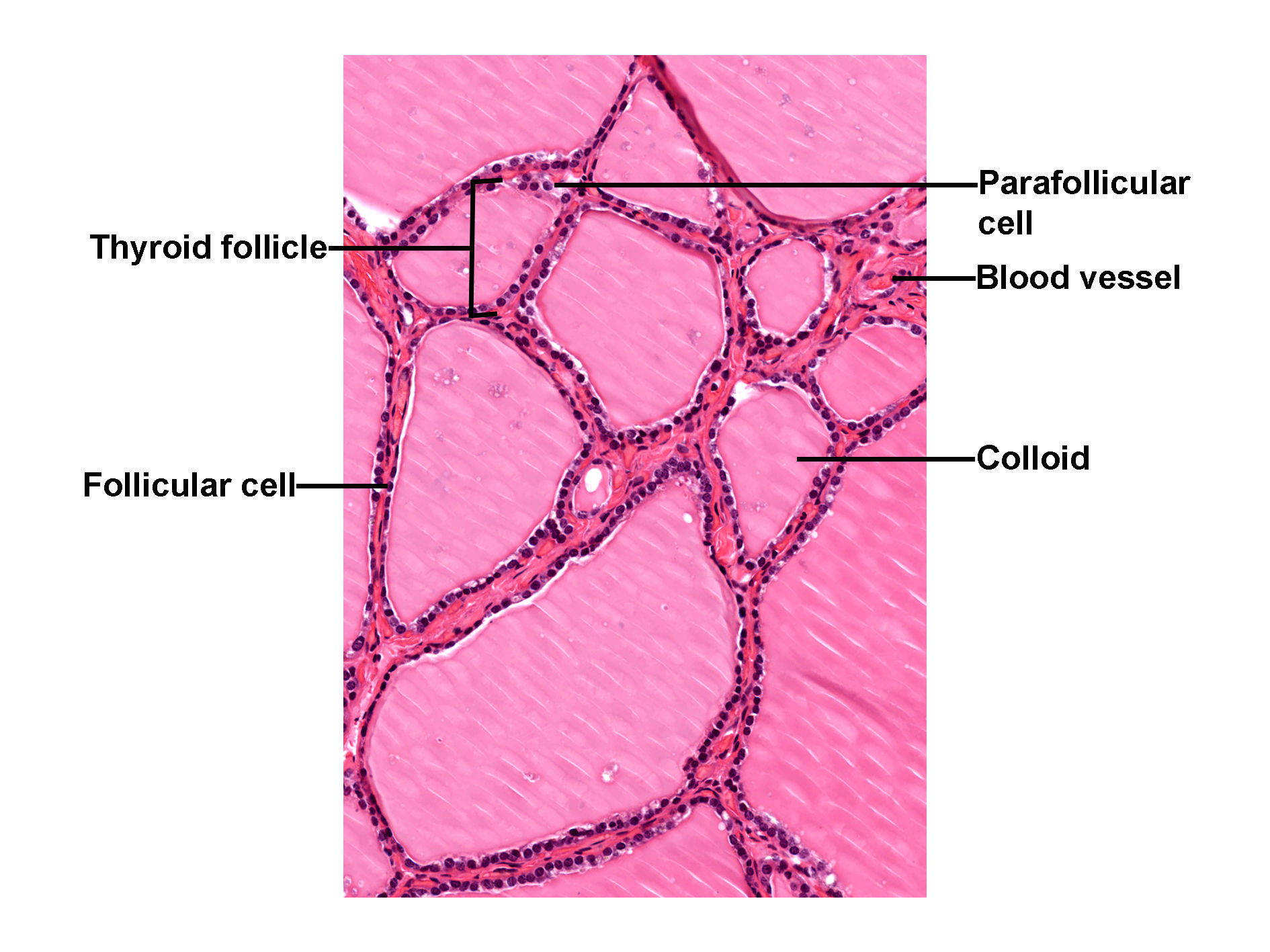 Histological section of the thyroid gland stained with H&E, showing multiple thyroid follicles filled with colloid. Each follicle is lined by simple cuboidal follicular cells responsible for thyroid hormone synthesis. Parafollicular cells (C cells) are located between follicles and secrete calcitonin. Blood vessels are visible in the interfollicular connective tissue. The image illustrates the organization of thyroid follicles and associated cell types.