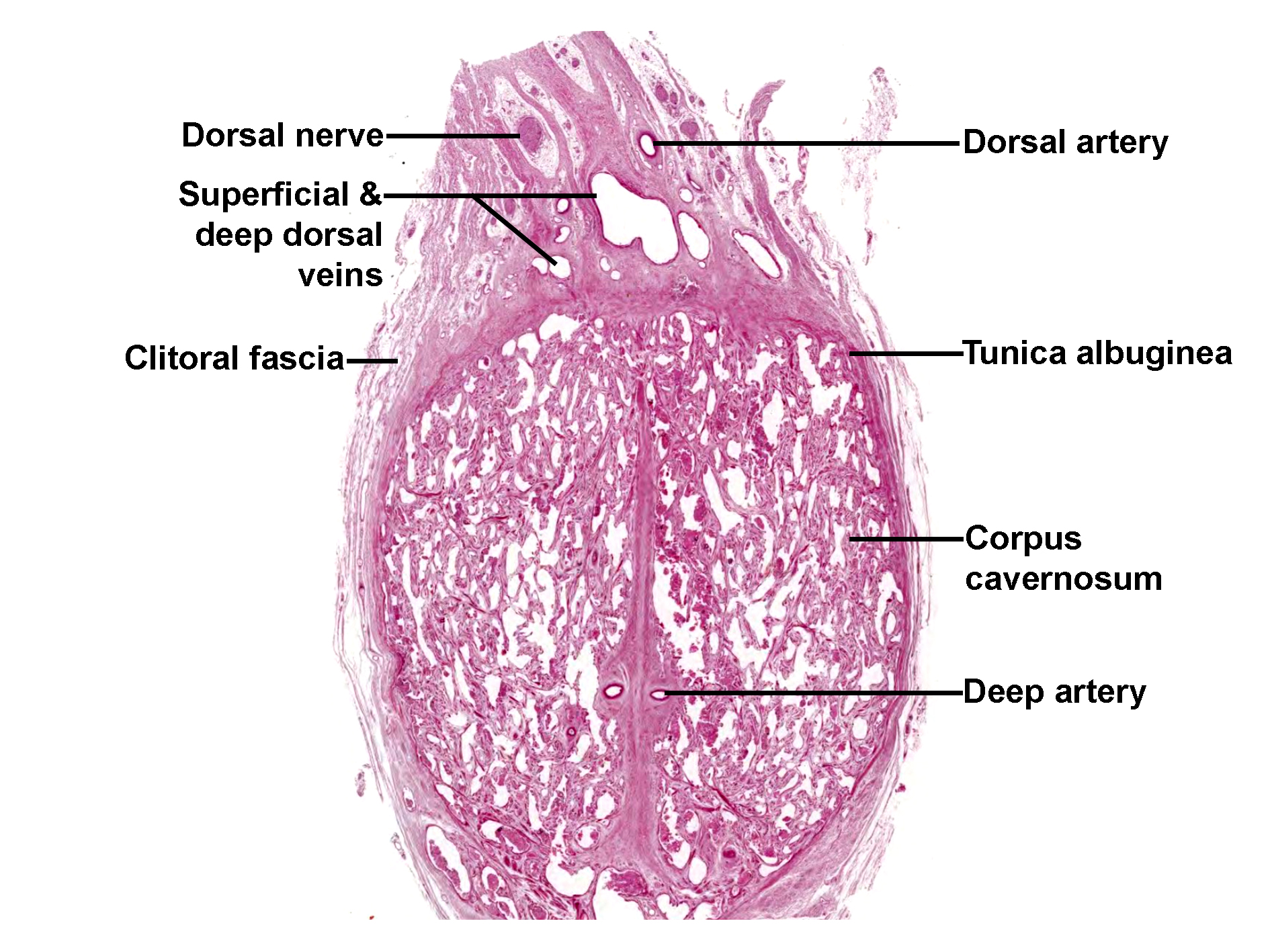 Histological section of the clitoris stained with H&E, showing the dorsal neurovascular structures and erectile tissue. At the dorsal aspect, the dorsal nerve, dorsal artery, and superficial and deep dorsal veins are visible beneath the clitoral fascia. The tunica albuginea surrounds the paired corpora cavernosa, which contain numerous vascular spaces. A deep artery runs centrally within the corpus cavernosum. The image illustrates the organization of erectile tissue and associated neurovascular components of the clitoris.