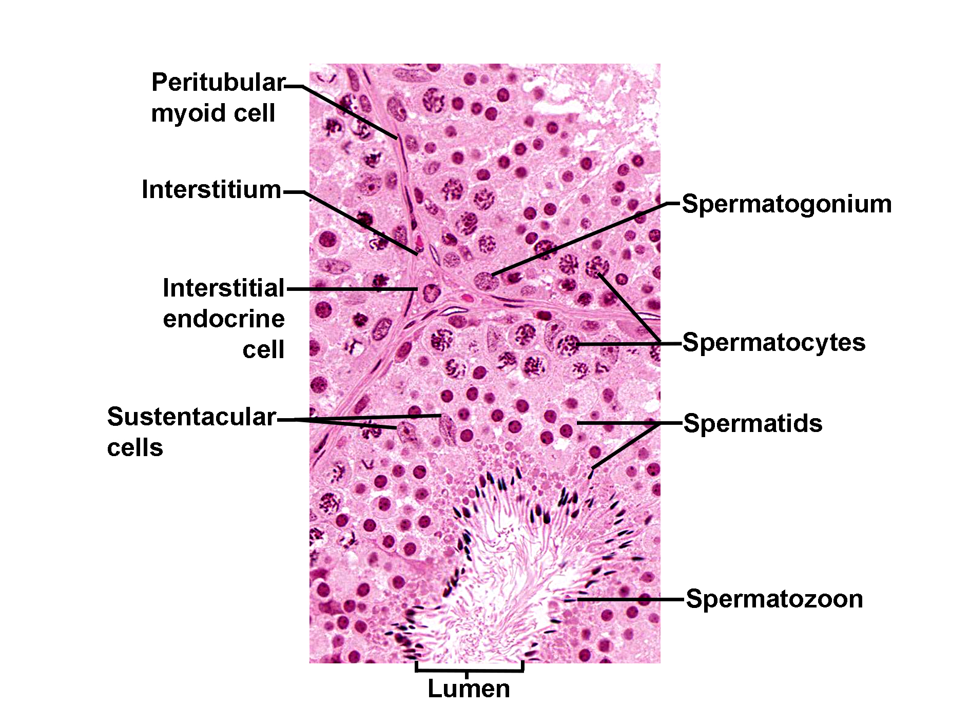 Histological section of a seminiferous tubule stained with H&E, showing the organization of cells involved in spermatogenesis. The lumen of the tubule contains mature spermatozoa with flagella projecting inward. Surrounding the lumen are layers of developing germ cells: spermatids closest to the lumen, followed by spermatocytes, and spermatogonia near the basal lamina. Sustentacular (Sertoli) cells extend from the basal layer toward the lumen, supporting the germ cells. The interstitial space between tubules contains interstitial endocrine (Leydig) cells and connective tissue. Peritubular myoid cells form a thin layer around the tubule. The image illustrates the structural arrangement of cells in the seminiferous epithelium and interstitium.