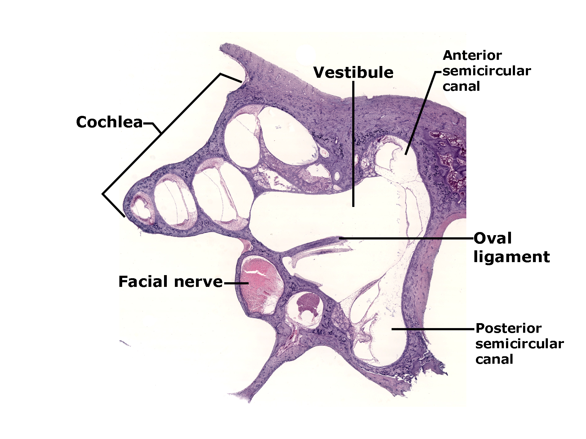 Histological section of the inner ear stained with H&E, showing the bony labyrinth and associated structures. The cochlea appears as a series of spiral chambers on the left. The vestibule occupies the central region, connecting to the anterior and posterior semicircular canals. The oval ligament is visible near the vestibule. The facial nerve is shown in cross-section adjacent to the cochlea. The image illustrates the spatial arrangement of the cochlea, vestibule, semicircular canals, and associated structures within the inner ear.