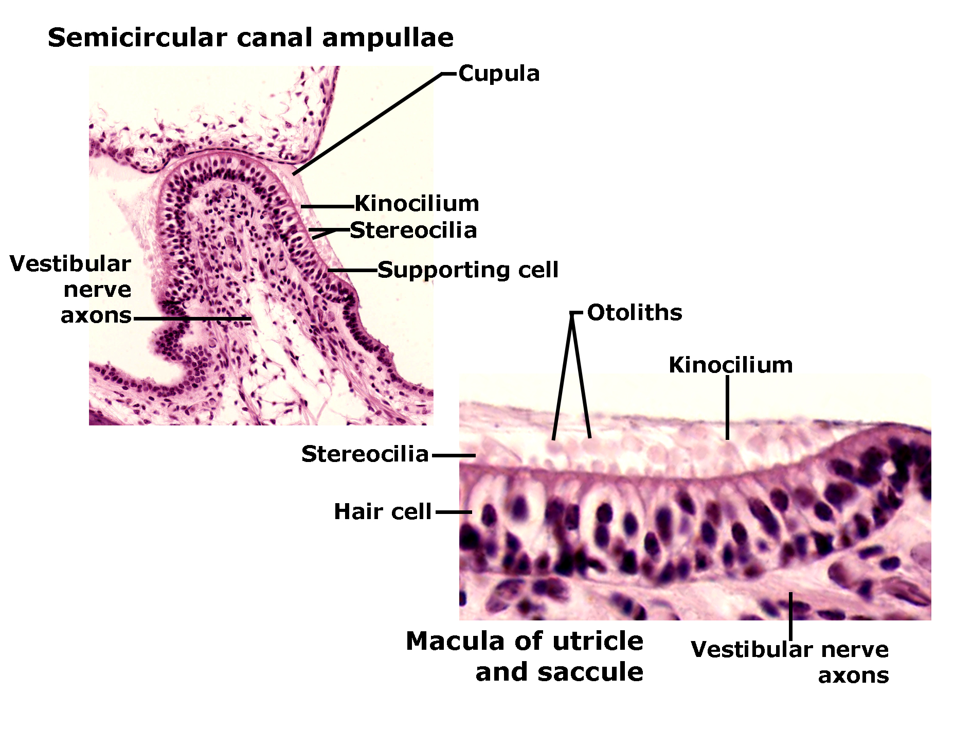 Histological sections of vestibular sensory structures stained with H&E. The left image shows the semicircular canal ampulla with a cupula projecting into the lumen. Hair cells with stereocilia and a single kinocilium are visible, supported by supporting cells. Vestibular nerve axons extend from the base of the sensory epithelium. The right image shows the macula of the utricle and saccule, featuring hair cells with stereocilia and kinocilium embedded in an otolithic membrane containing otoliths. Vestibular nerve axons are present beneath the epithelium. The image illustrates sensory structures responsible for detecting angular and linear acceleration.