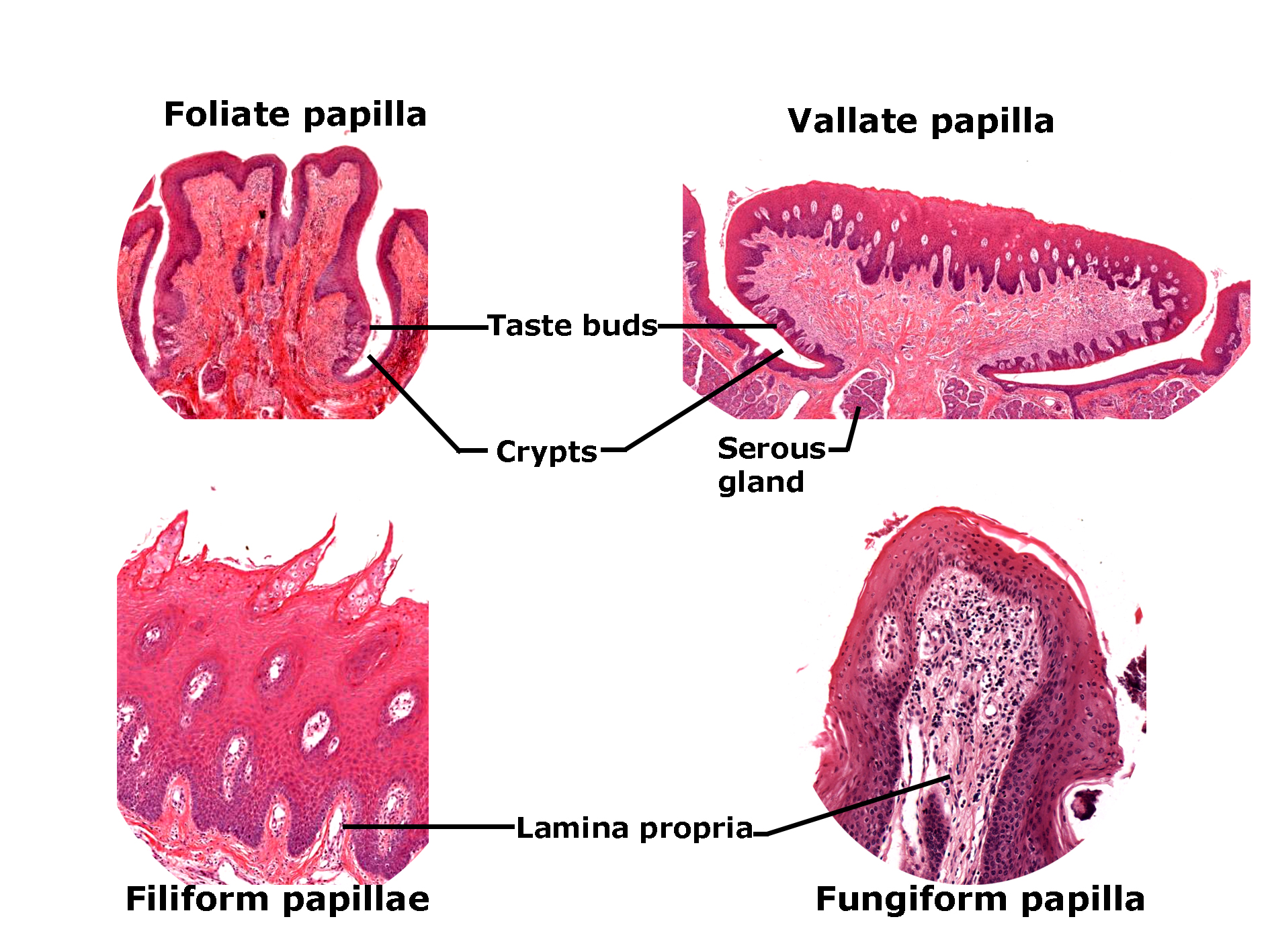 Detailed Alt Text for 87.TonguePapillae_low.jpg Histological sections of four types of tongue papillae stained with H&E. The foliate papilla shows deep folds with taste buds located along the sides and crypts between them. The vallate papilla displays a large circular structure with surrounding crypts and underlying serous glands. The filiform papilla consists of elongated projections with a keratinized surface and underlying lamina propria. The fungiform papilla appears rounded with a central core of lamina propria and a non-keratinized epithelial surface. The image illustrates structural differences among papillae types and their associated features such as taste buds and glands.