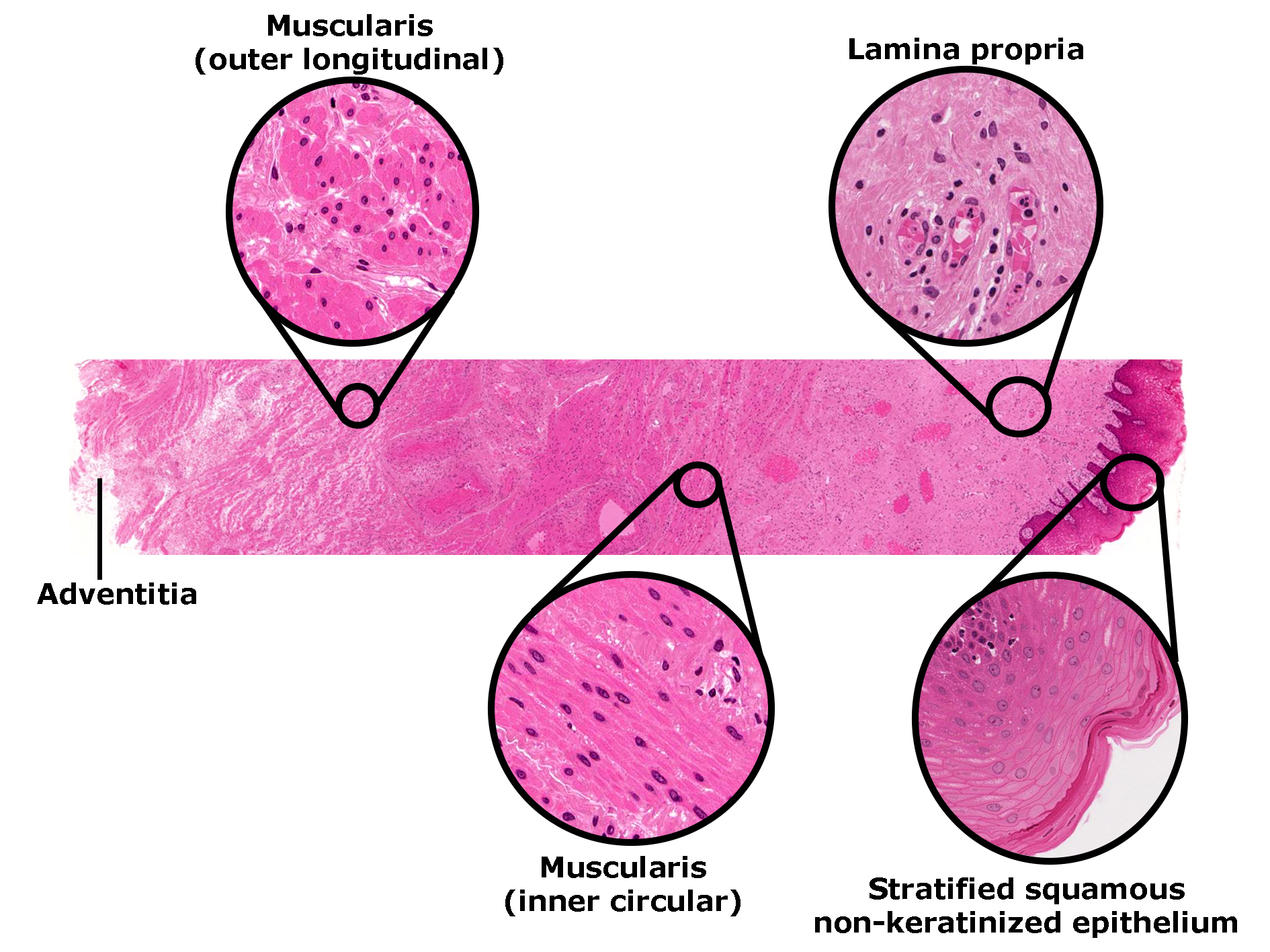Histological section of the vaginal wall stained with H&E, showing its layered structure. The mucosa is lined by stratified squamous non-keratinized epithelium, highlighted in a magnified inset. Beneath the epithelium lies the lamina propria composed of connective tissue. The muscularis layer consists of inner circular and outer longitudinal smooth muscle fibers, shown in separate insets. The outermost layer is the adventitia, which blends with surrounding connective tissue. The image illustrates the organization of the vaginal wall and its epithelial and muscular components.
