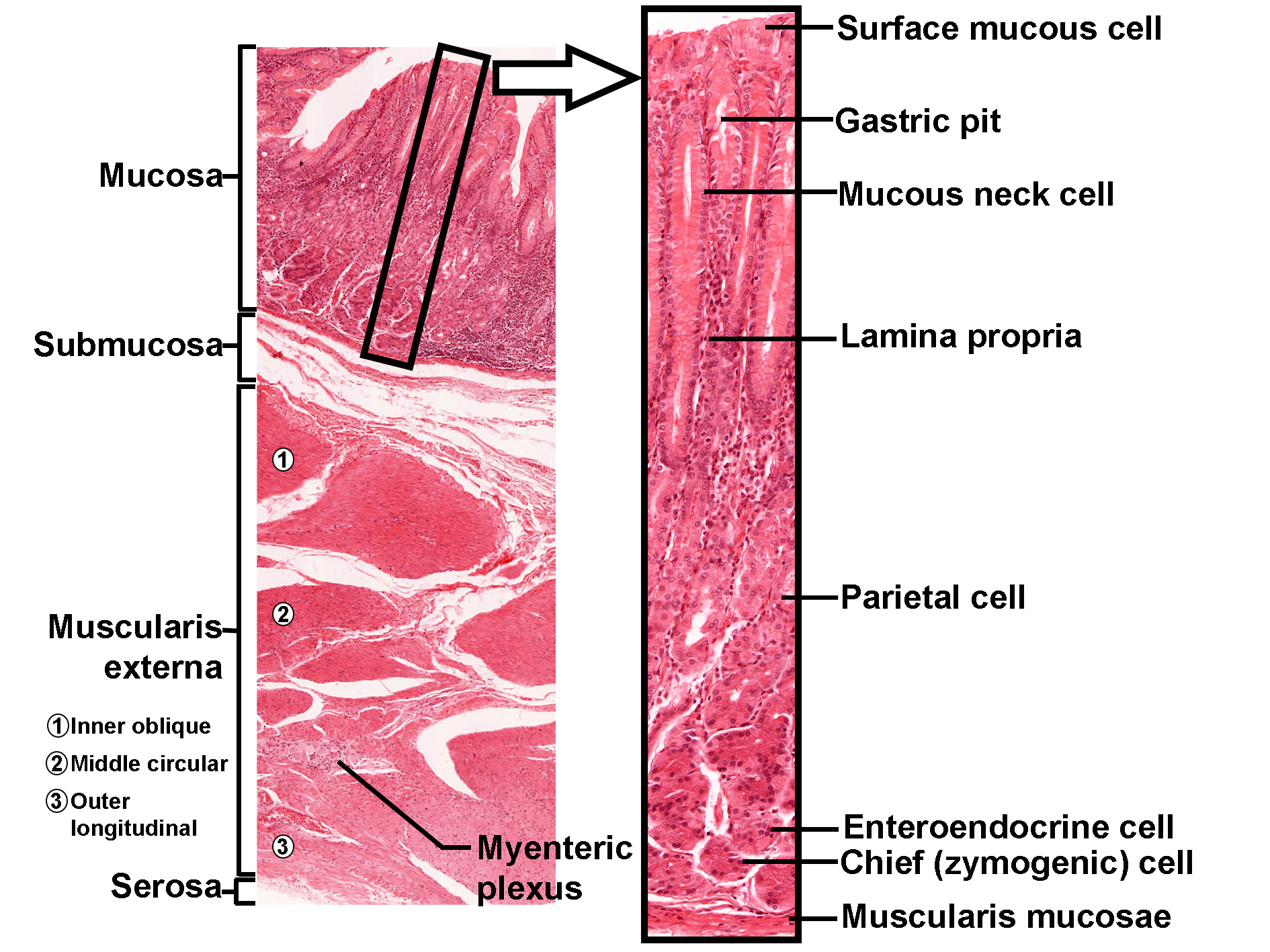 Histological section of the stomach stained with H&E. The left panel shows a low-magnification view of the stomach wall with distinct layers labeled: mucosa at the top, submucosa beneath it, muscularis externa with three layers (inner oblique, middle circular, and outer longitudinal), and serosa at the bottom. The myenteric plexus is indicated within the muscularis externa. A black box highlights a portion of the mucosa, which is shown in higher magnification in the right panel. In this magnified view, the surface mucous cells lining the lumen are visible, leading into gastric pits. Below the pits are mucous neck cells within the lamina propria. Deeper in the mucosa, parietal cells are present, followed by enteroendocrine cells and chief (zymogenic) cells. The muscularis mucosae forms the boundary at the base of the mucosa. The image illustrates the organization of gastric glands and epithelial cell types within the stomach mucosa.