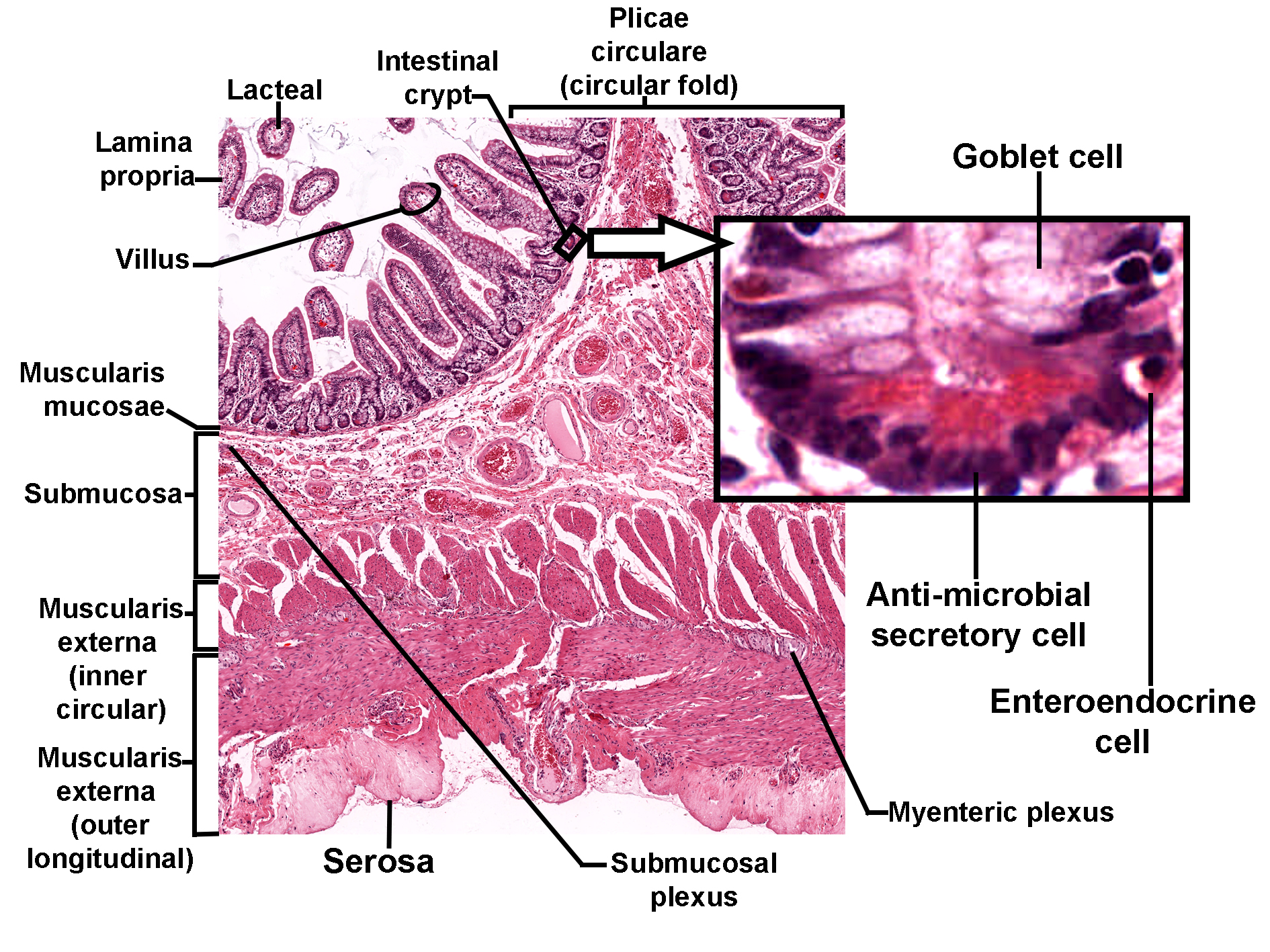 Alt Text for 56.Jejunum_Ileum_low.jpg Histological section of the jejunum stained with H&E, showing the structural organization of the intestinal wall. The mucosa forms prominent plicae circulares (circular folds) lined with villi and intestinal crypts. Each villus contains a lacteal within the lamina propria. The muscularis mucosae separates the mucosa from the submucosa, which contains the submucosal plexus. Beneath this, the muscularis externa consists of inner circular and outer longitudinal layers, and the outermost serosa is visible. A magnified inset highlights epithelial cells of the villus, including goblet cells, anti-microbial secretory cells, and enteroendocrine cells. The image illustrates adaptations for nutrient absorption and immune defense in the small intestine.