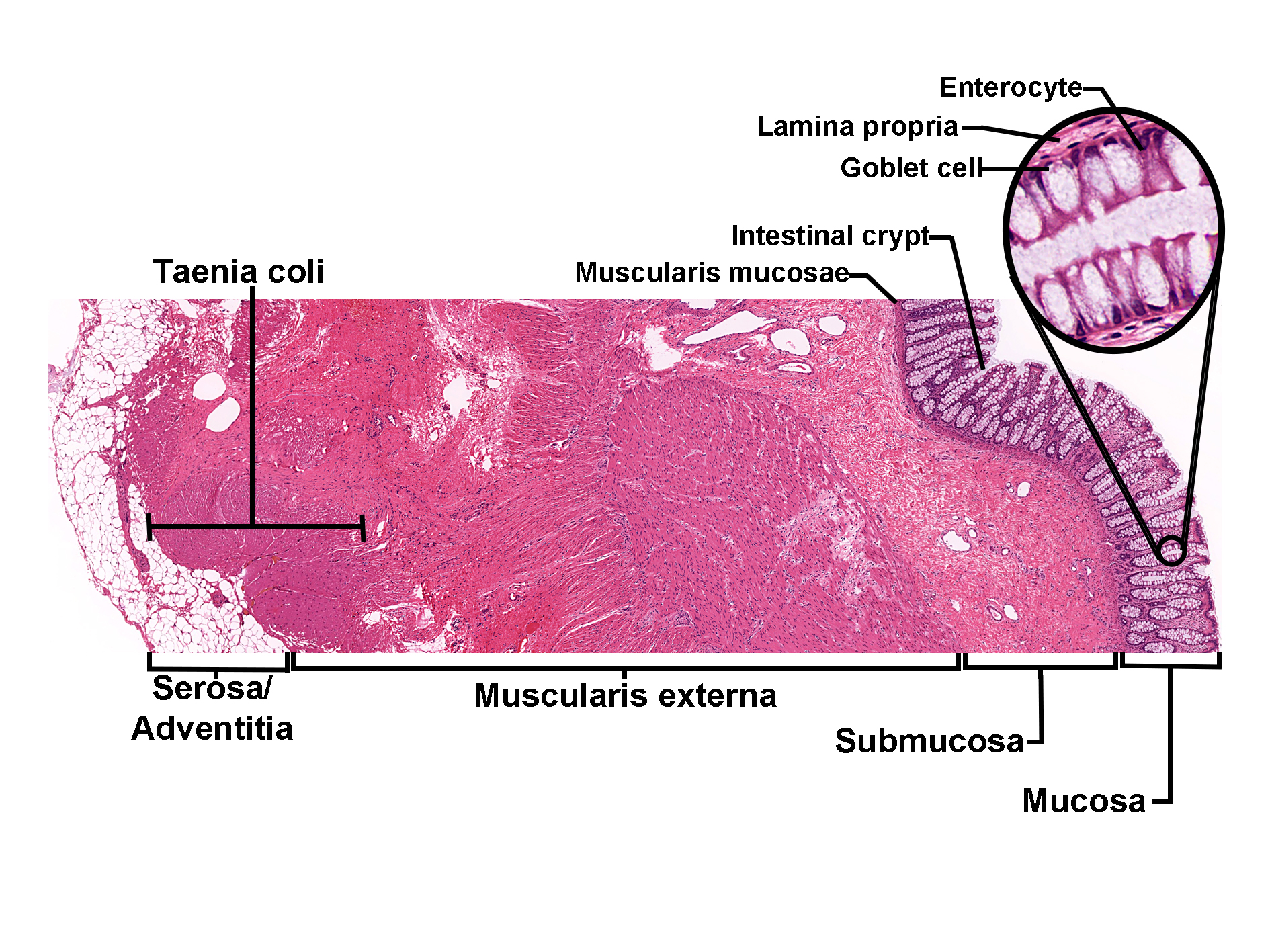 Histological section of the colon stained with H&E, showing the layered structure of the large intestine. The mucosa contains intestinal crypts lined by enterocytes and goblet cells, highlighted in a magnified inset. The lamina propria lies beneath the epithelium, followed by the muscularis mucosae. The submucosa is visible below, and the muscularis externa consists of thick smooth muscle layers forming the taenia coli. The outermost layer is the serosa or adventitia. The image illustrates the organization of the colon wall and its epithelial cell types.